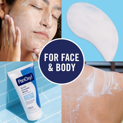 anOxyl Antimicrobial Acne Creamy Wash with 4% Benzoyl Peroxide — 6 oz